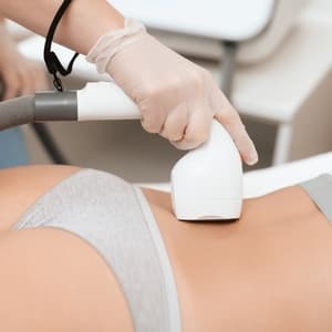 Paquete Láser Espalda Baja at Blue Astra Esthetic in Vega Alta, PR