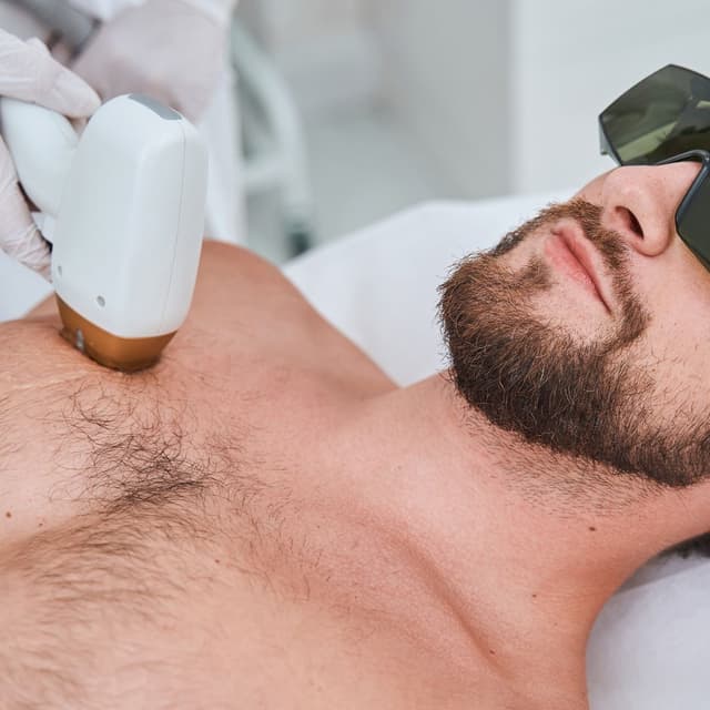 Paquete Láser Pecho at Blue Astra Esthetic in Vega Alta, PR